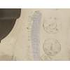 DEPOSITO EXPANSION 217101893R 